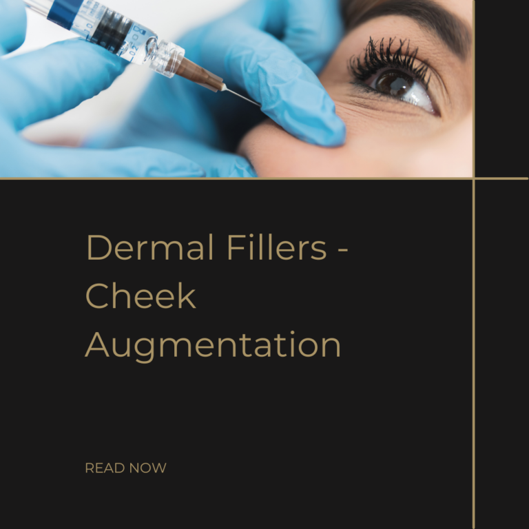 Dermal Fillers - Marionette Lines