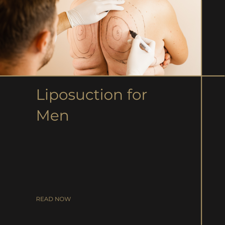 Liposuction for Men