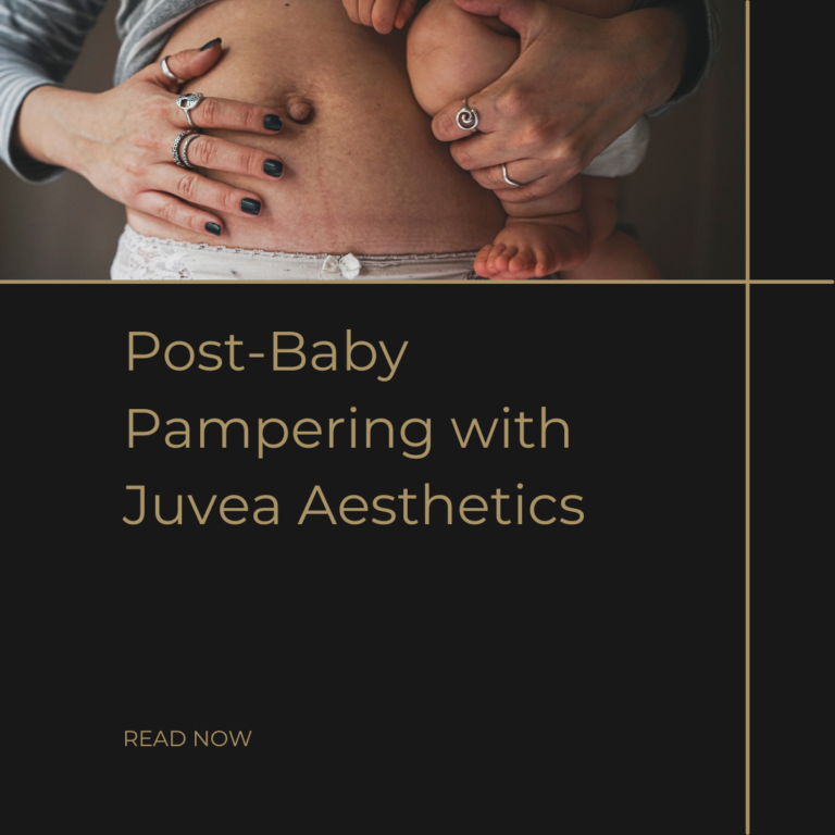 "Post-Baby Pampering with Juvea Aesthetics" with an image of a postpartum woman "Read More"